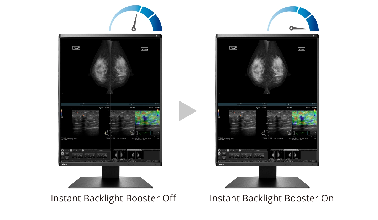 Instant Backlight Booster